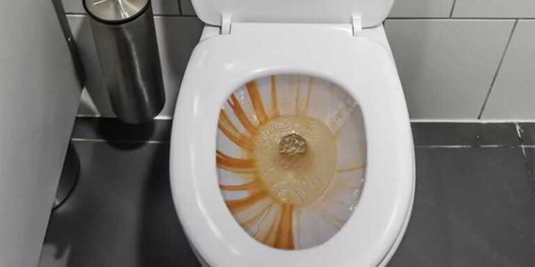 toilet filled with toilet stains