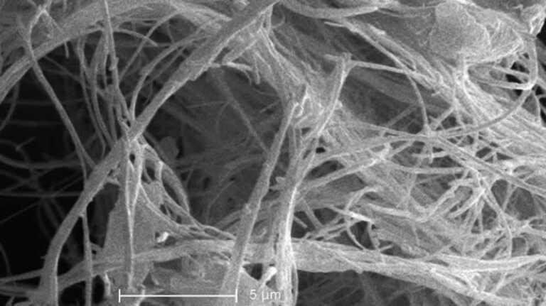particles of asbestos magnified