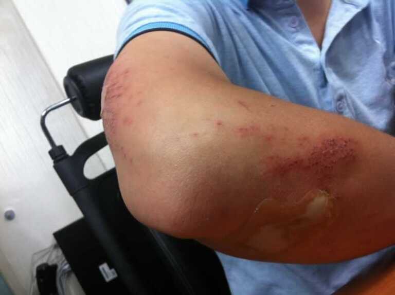 Have You Suffered An Injury Recently