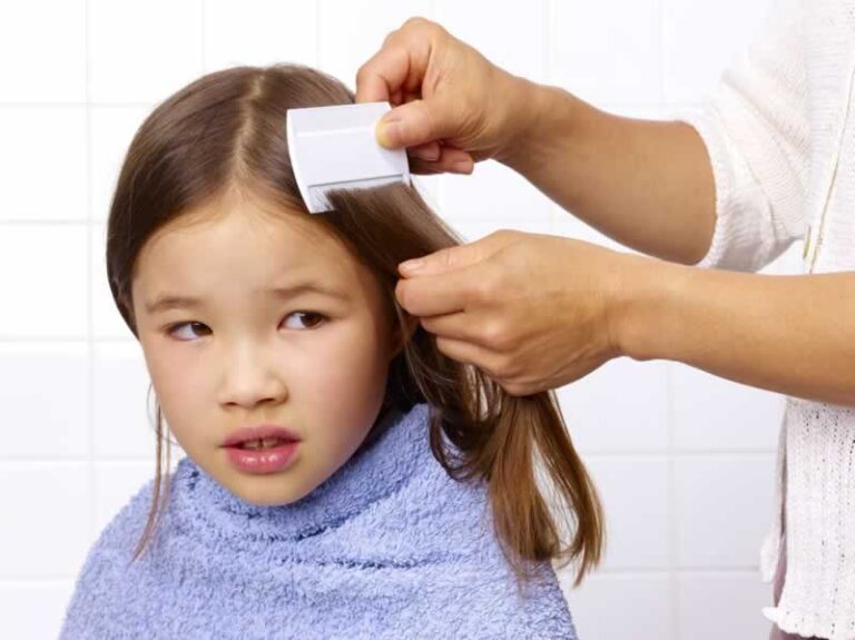 cleaning lice eggs from hair