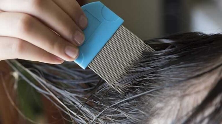 removing lice from hair